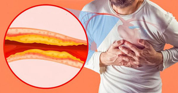 Viên giảm cân Kentoushi Nhật Bản (2)