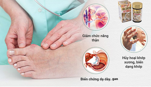Viên uống hỗ trợ điều trị Gút The Goutto Ribeto Nhật Bản 2